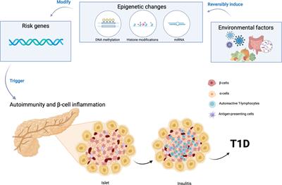 Gene-environment interaction in the pathophysiology of type 1 diabetes